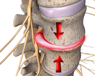 Chiropractic Coeur d'Alene ID Spine Red