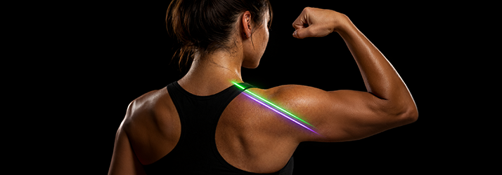 Erchonia Laser Device Being Used On A Patient's Shoulder